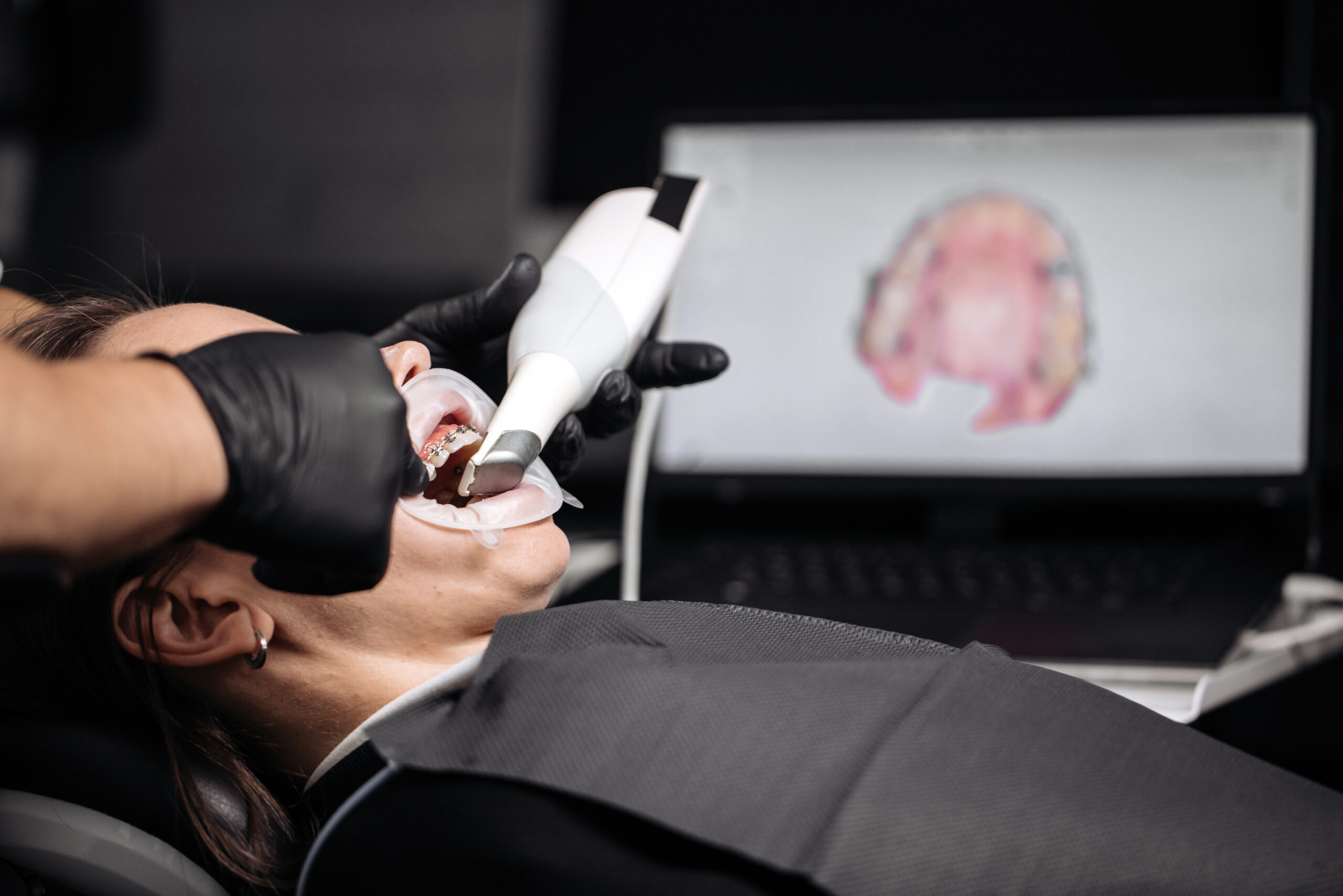 Conceptual dental technology, 3D scanning. A dentist performs a 3D scan of the oral cavity using an intraoral scanner in a modern dental clinic.